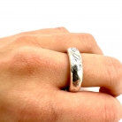 anello dodo